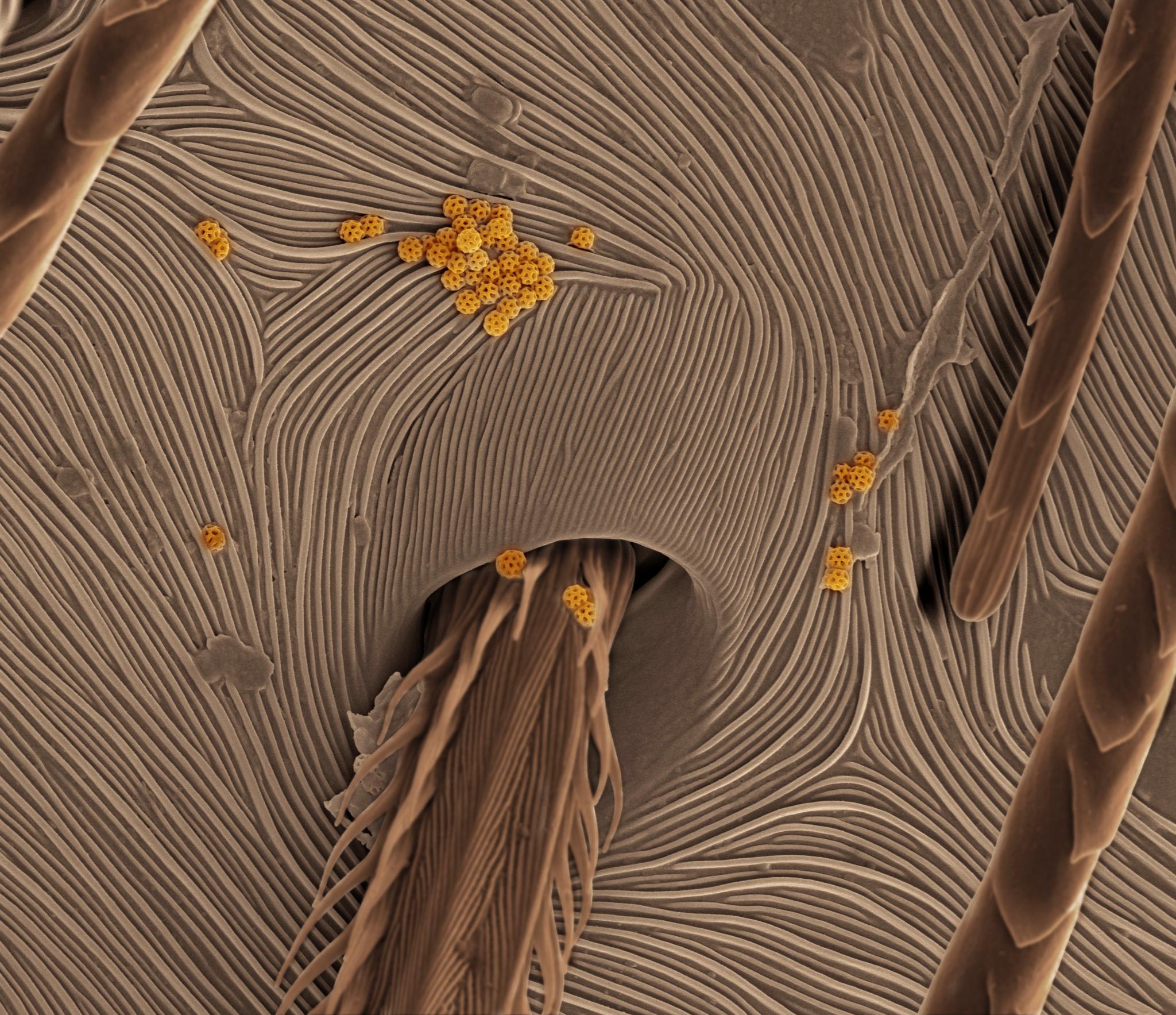 Spider Skin Up close and personal, a scanning electron micrograph