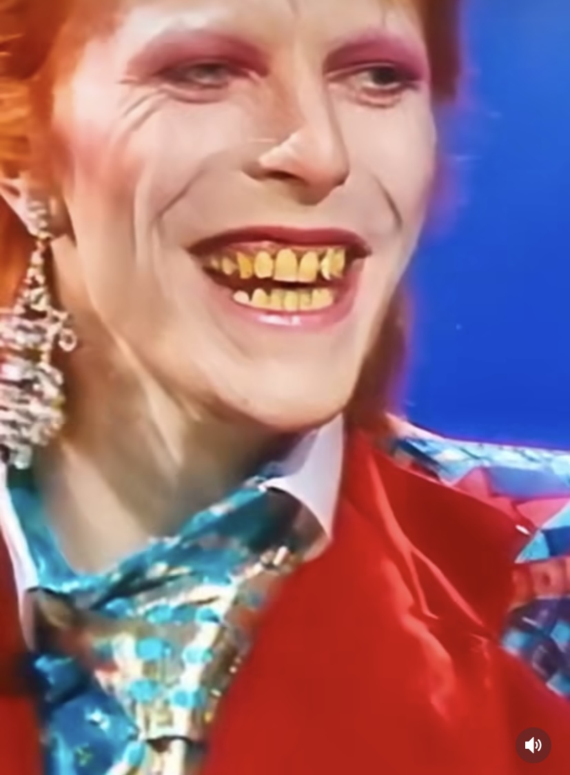 David Bowie Teeth