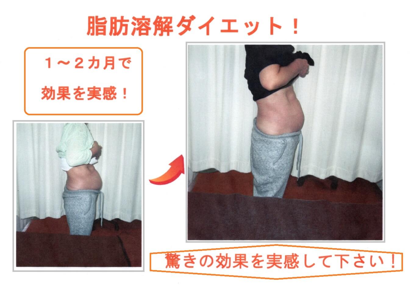 ダイエットを始めるなら今