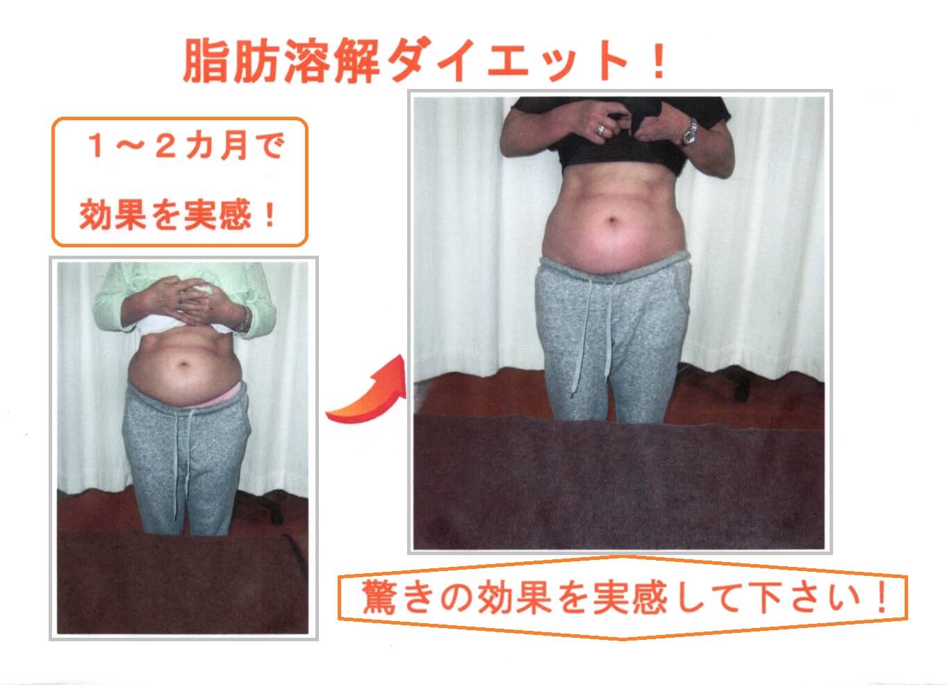 脂肪溶解ダイエット　驚きの効果正面""