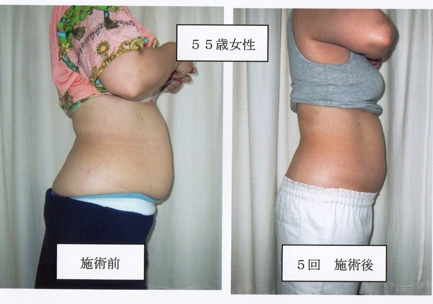 ダイエットするなら整体院