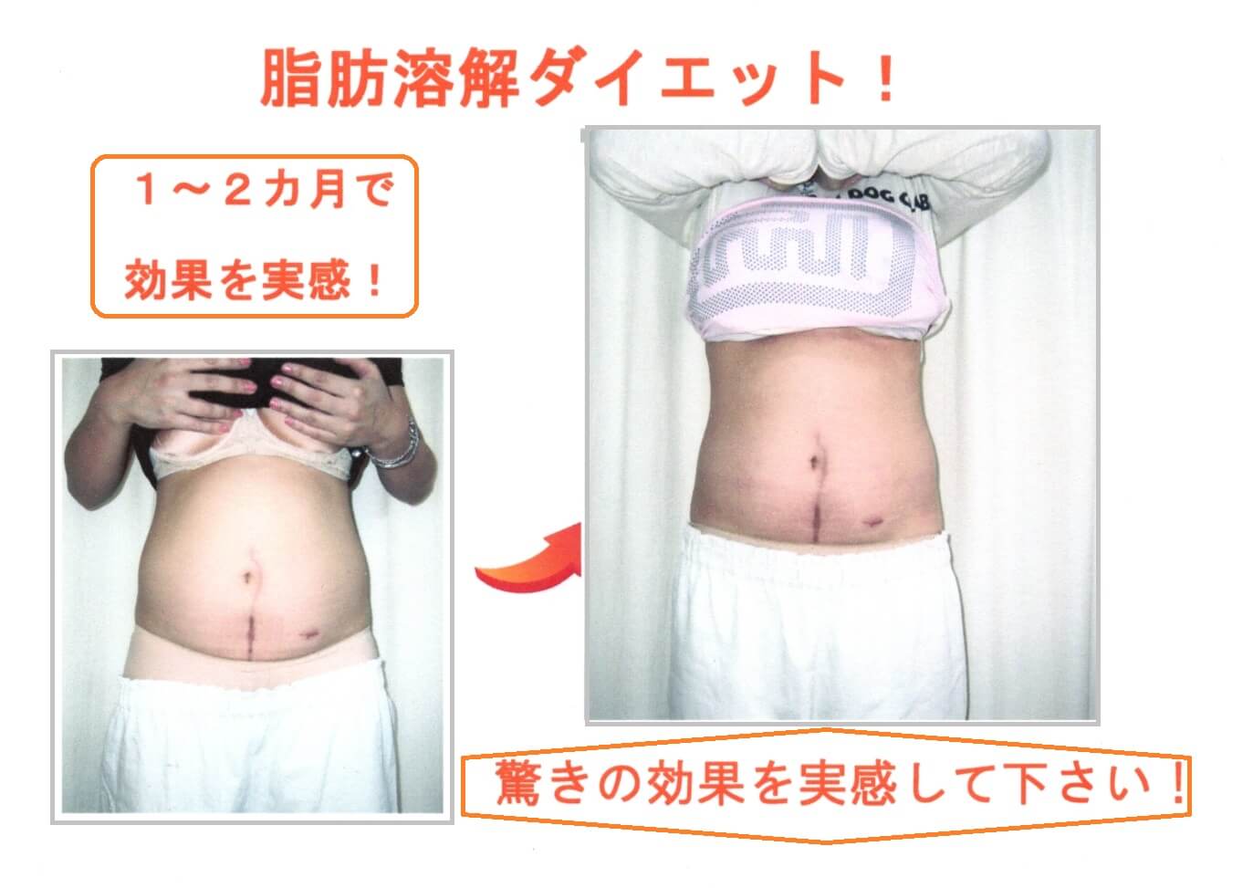 高知できれいに痩せられると人気のダイエット