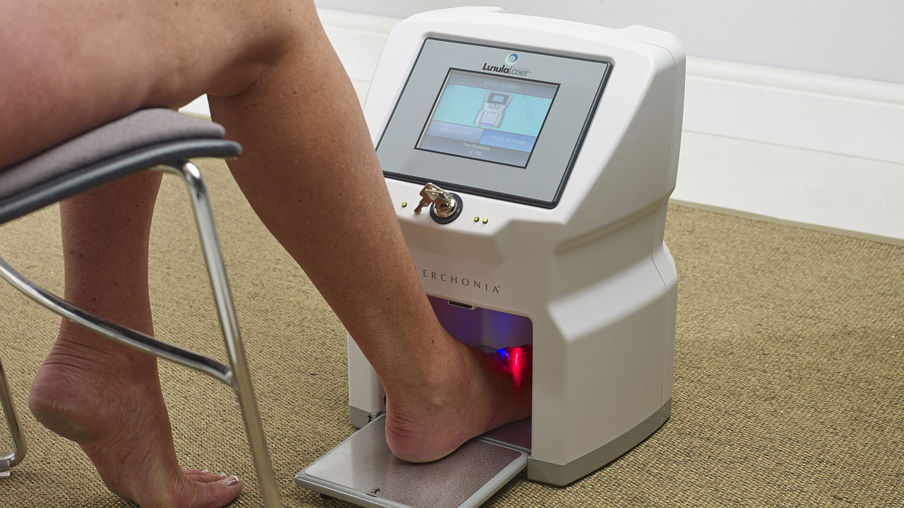 Lunula Laser NextGen Onychomycosis Treatment Only from Erchonia