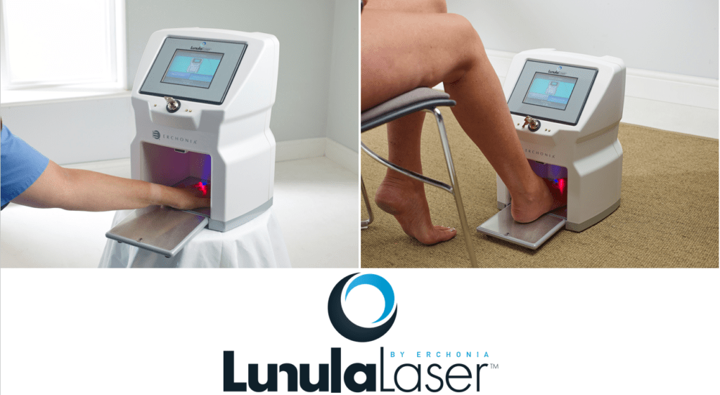 Lunula Nail Fungus Laser Low Level Laser Therapy