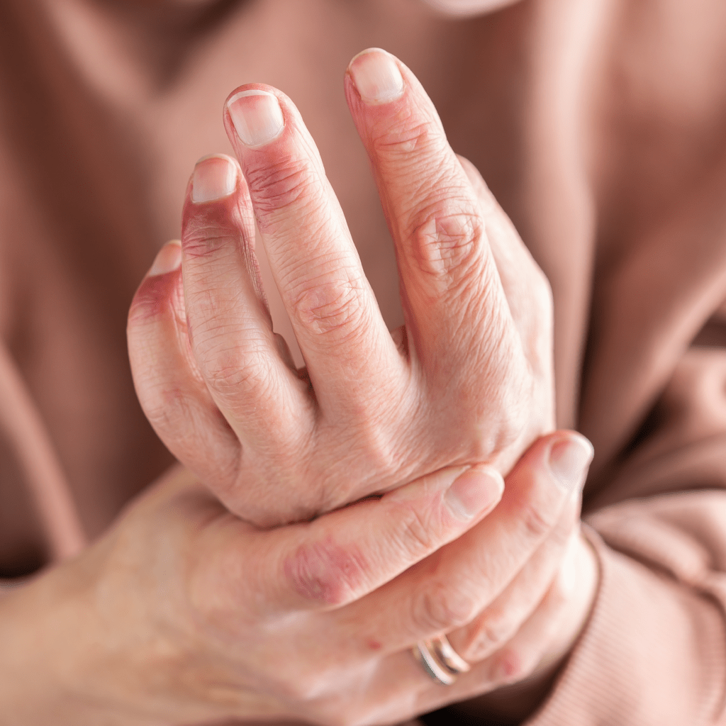 Does Magnesium help with Eczema? Magnesium Café