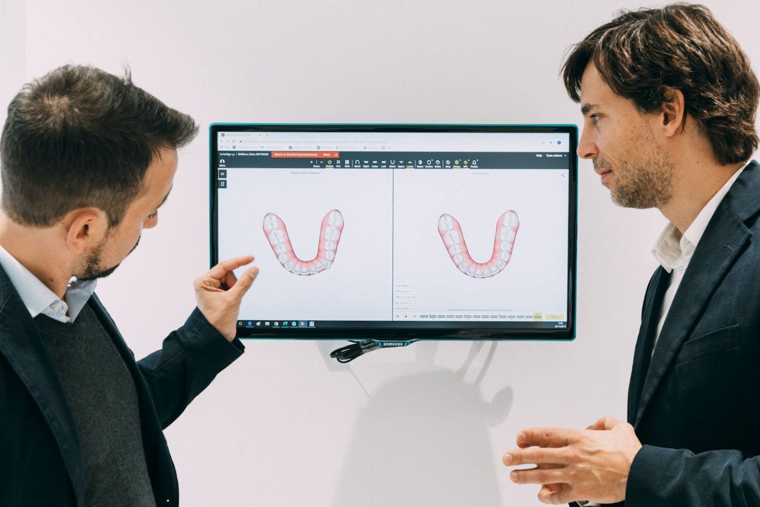 Train Tracks Brackets vs Invisalign 2023 Maida Smiles (W. London)