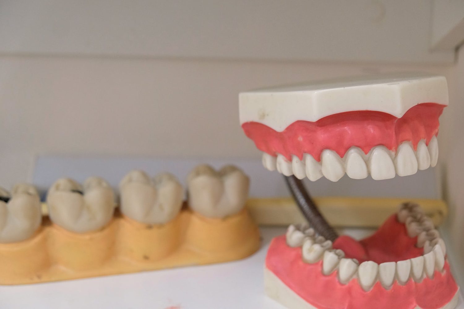 The Pros And Cons Of SnapOn Dentures Maida Smiles ClinicMaida Smiles