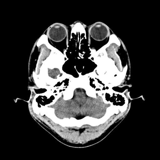 優雅 Ct スキャン 費用 矢じり