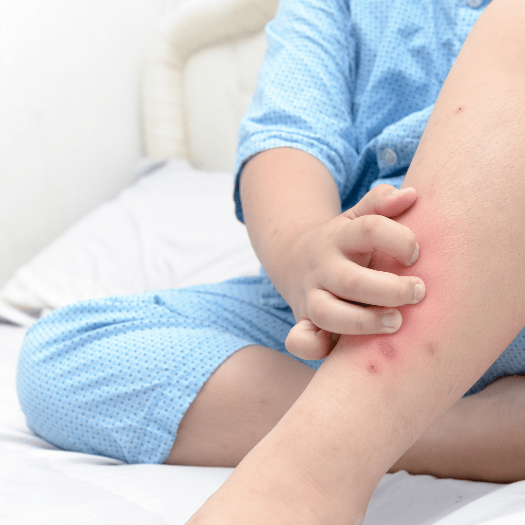 Few Tips for Repelling Mosquitoes from Baby’s Skin Make Me Feel