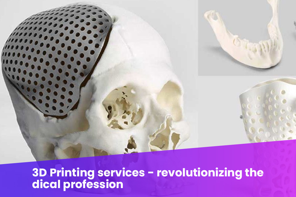 3D Printing services revolutionizing the medical profession