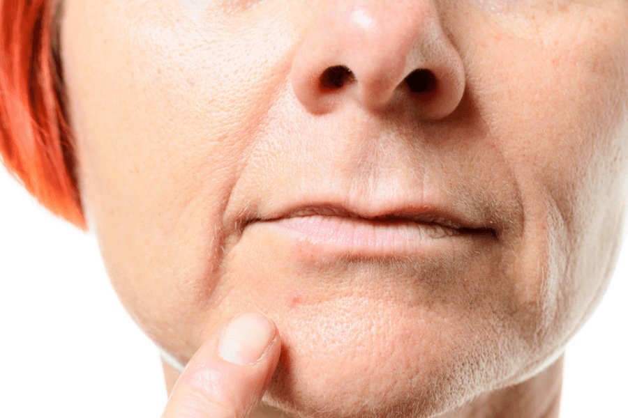 Acne in the Menopausal Years the makeup obsessed mom blog