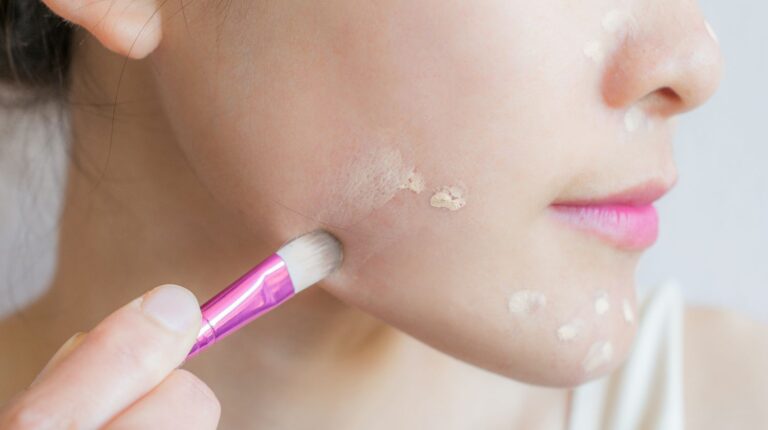 Hide acne scars with these amazing and easy makeup tips