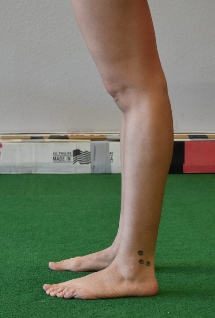 Ehlers Danlos Syndrome Makovicka Physical Therapy