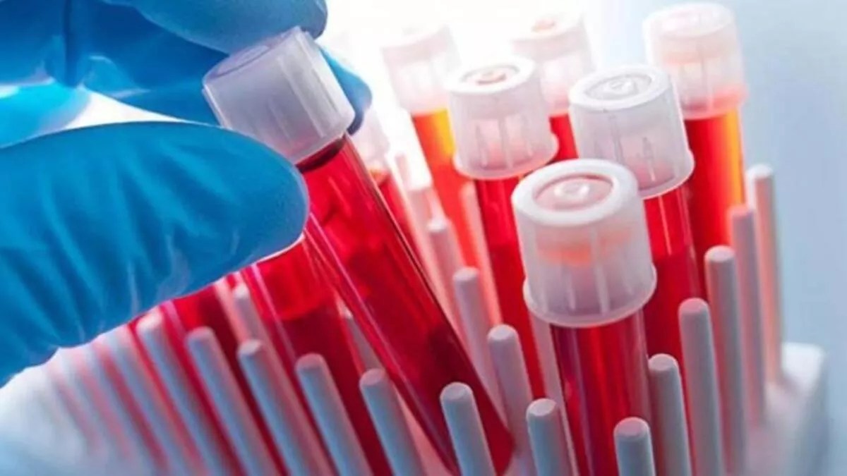 CRP Nedir, Ne İşe Yarar? MaksatBilgi