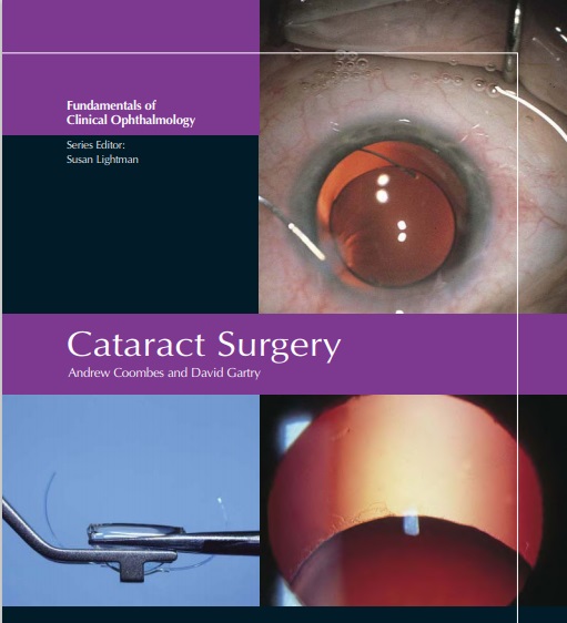 Cataract Surgery المكتبة الإسلامية العامة