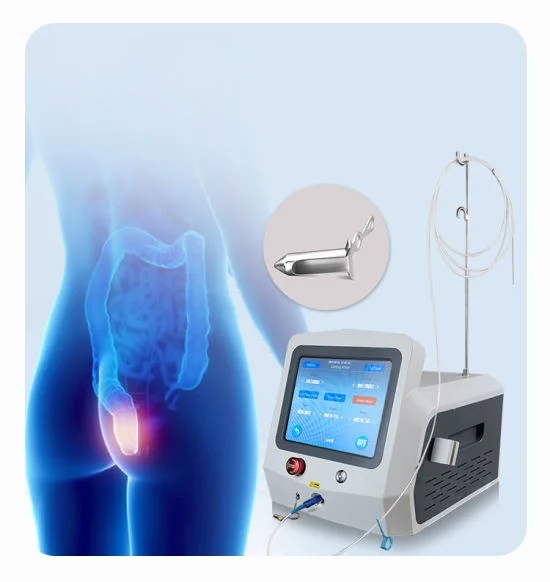 Laser treatment for piles in Calicut, Piles treatment in Calicut