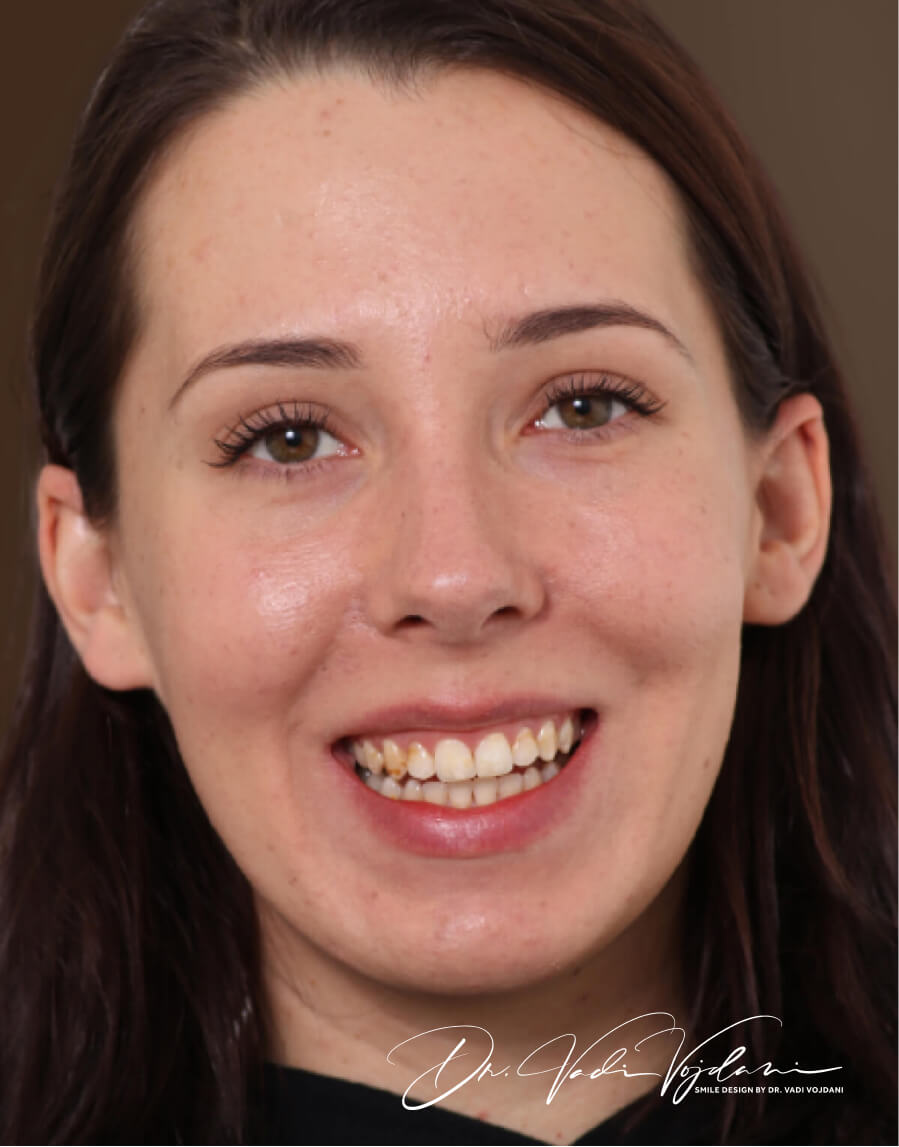 Unley Dentist Malvern Dental & Smile Design