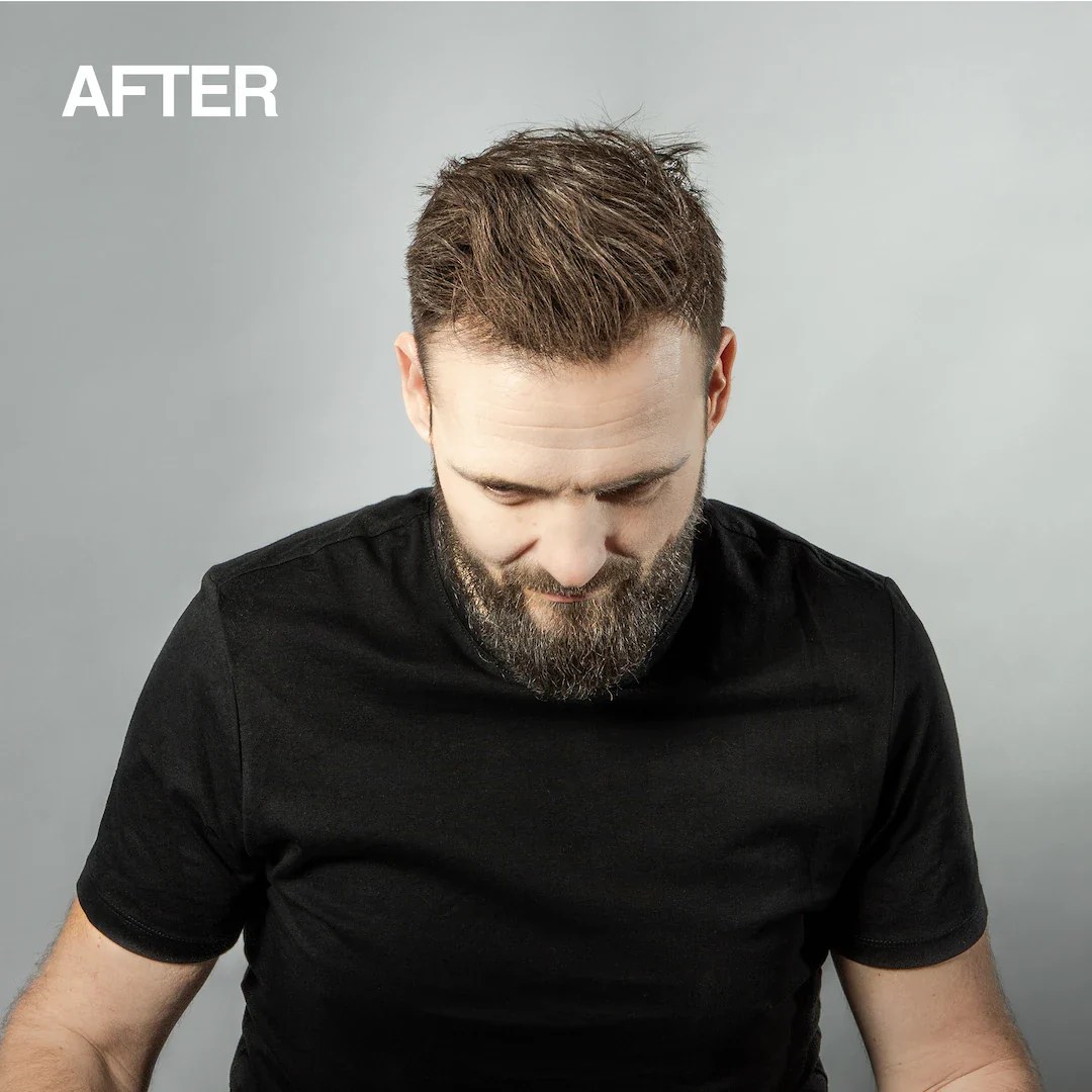 2 x Mane Hair Thickening Sprays (200ml) + Shampoo (100ml) Mane