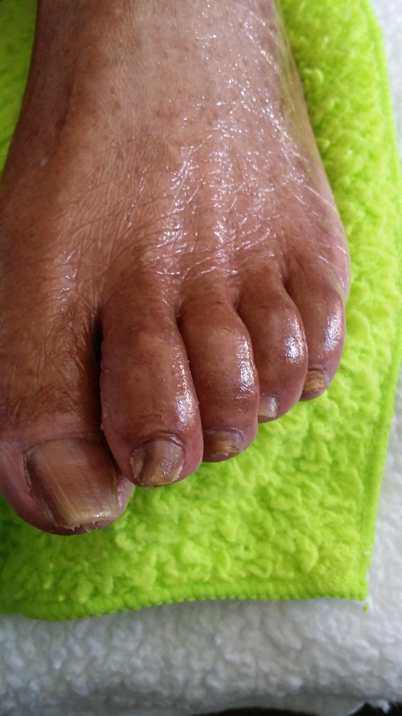 Mobile Pedicure Service For Seniors Near Me Dmttrip