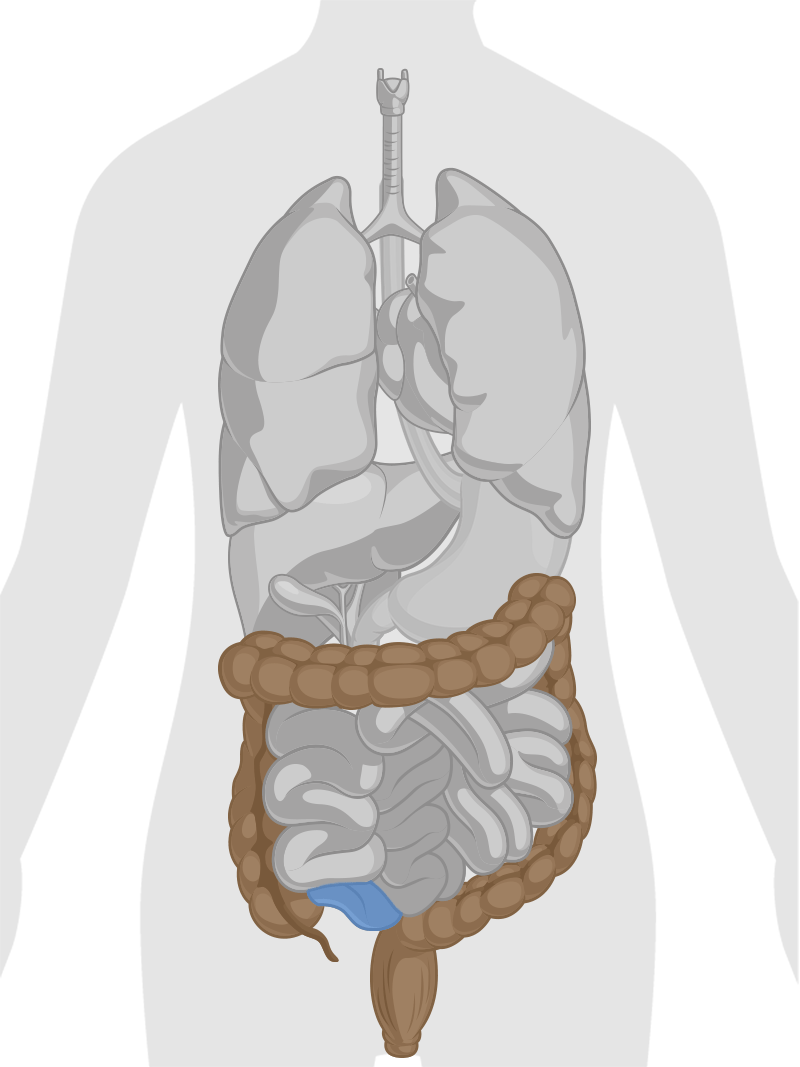 Colonoscopy | Dr. Alexander Mantas - Gastroenterologist in Dallas TX