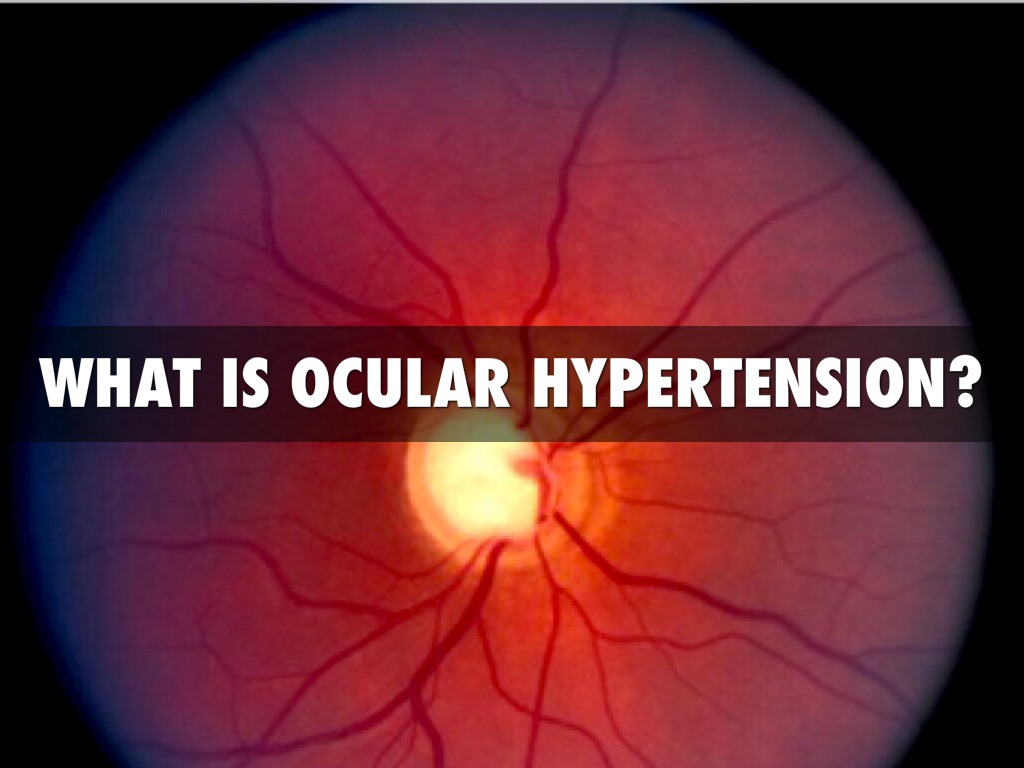 Ocular Hypertension Causes, Symptoms, And Treatments