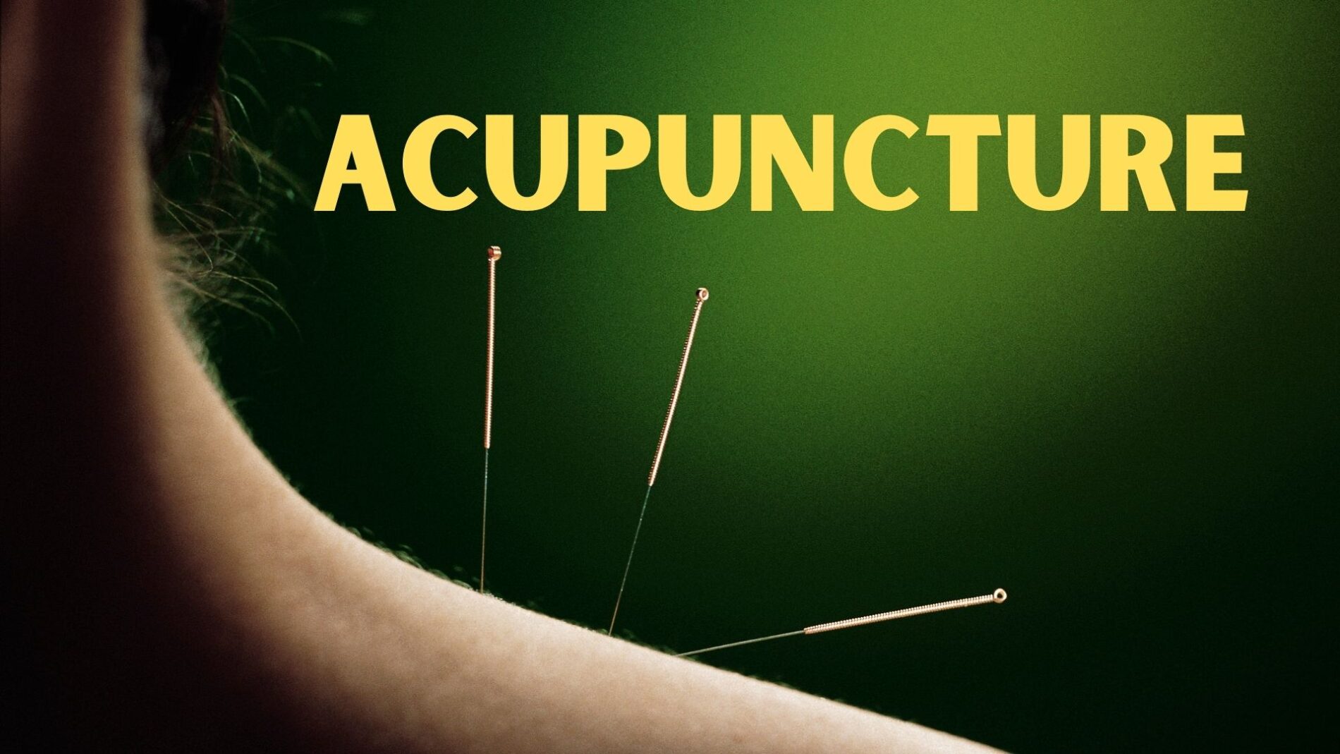 Acupuncture How it Works, Benefits, Risk Factors, Results