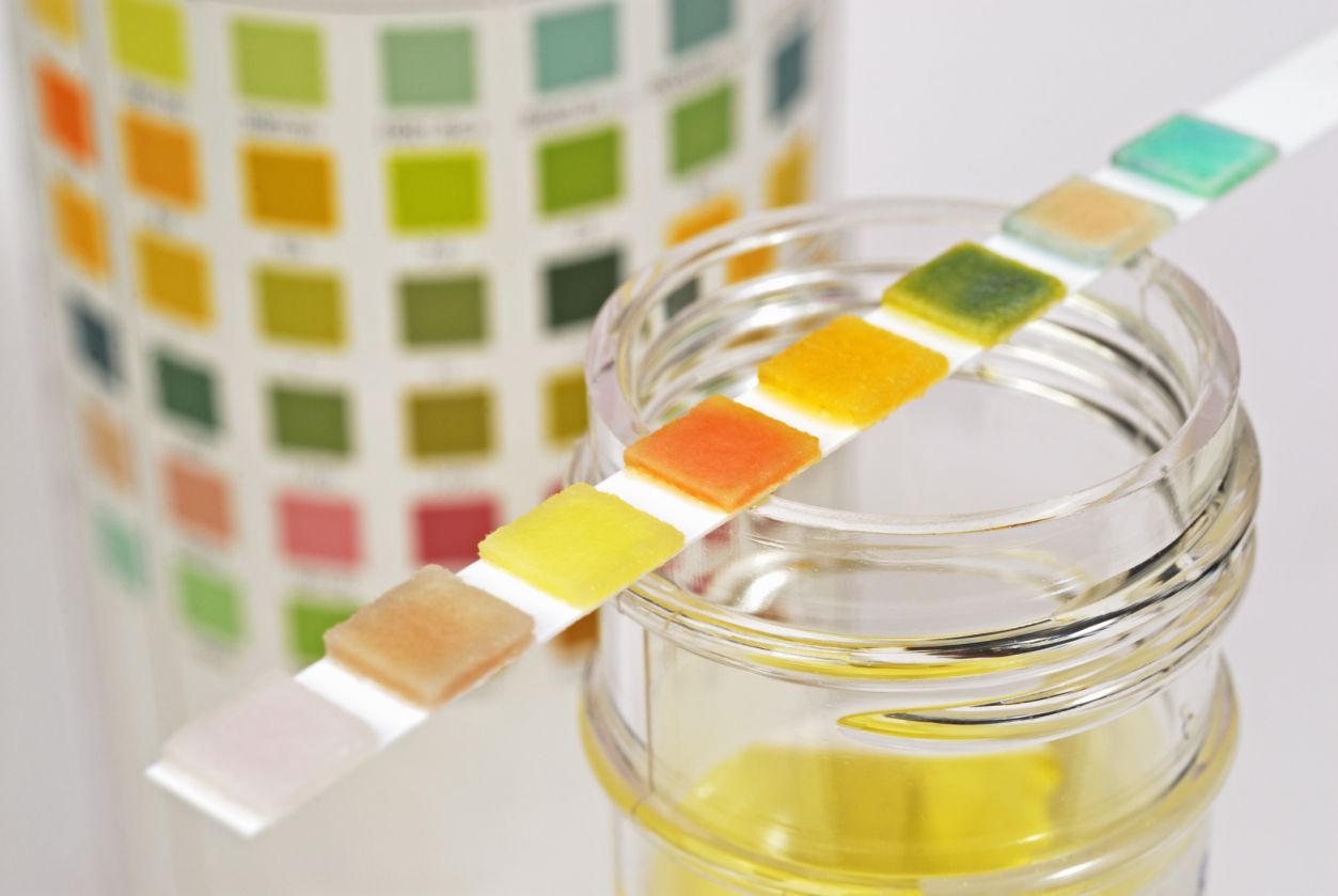 Employee Drug Testing 7 Things You Need To Know Mantracare