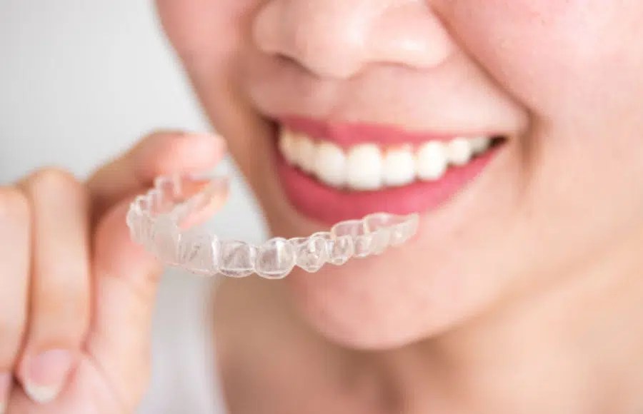 Straighten Your Teeth with Invisalign Maple Grove Dentistry Dental