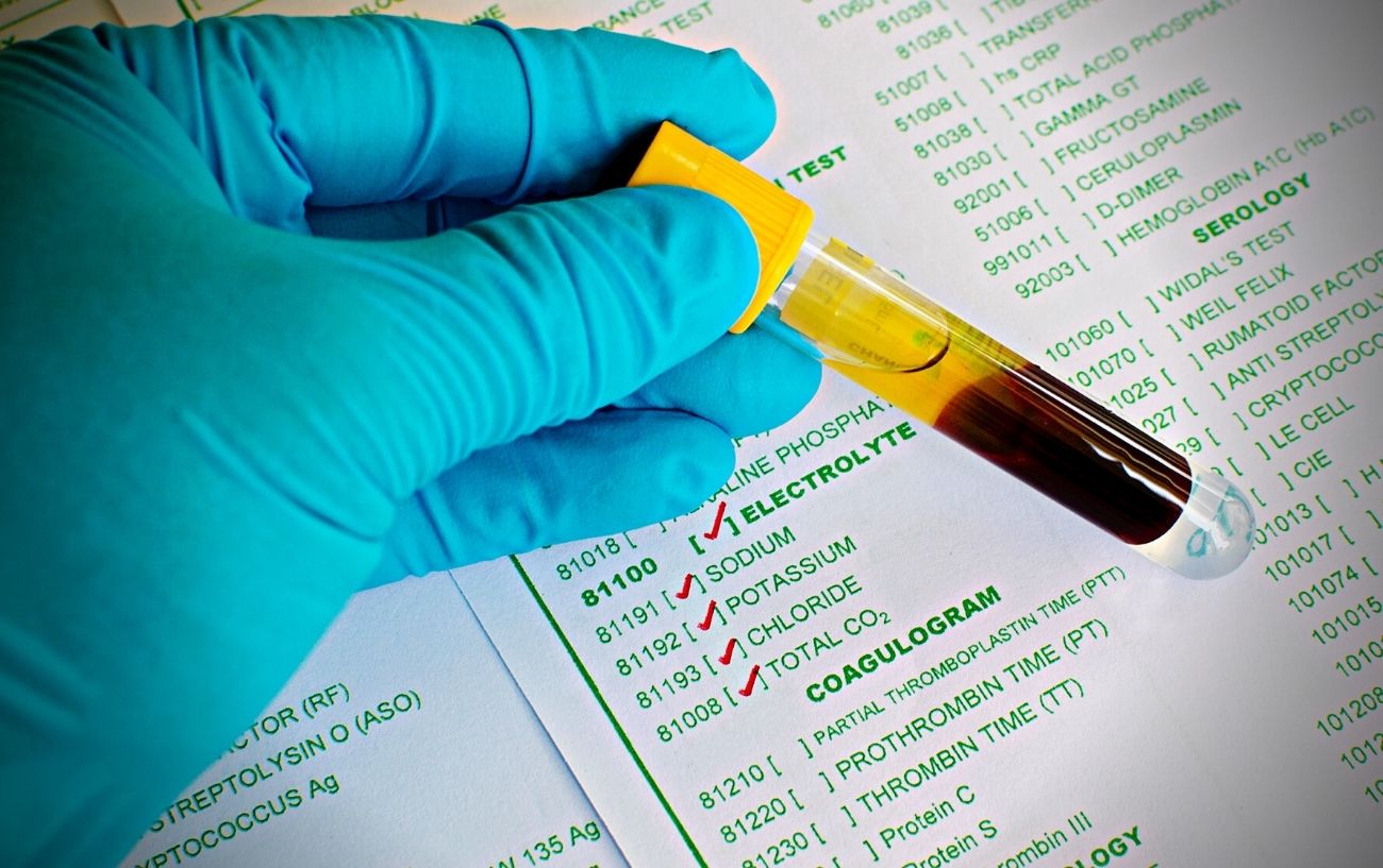 16 Signs You May Have An Electrolyte Imbalance