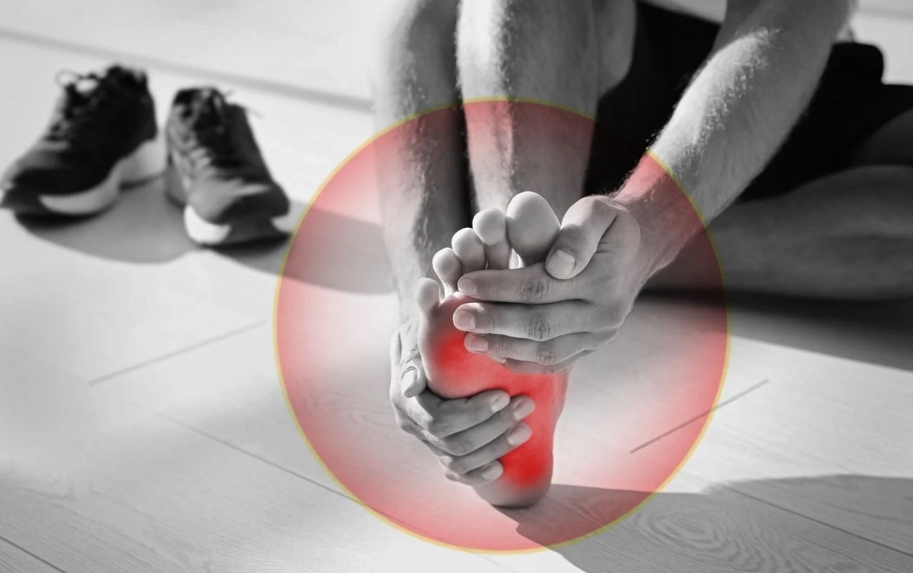 Pain In Arch Of Foot After Running? 3 Potential Causes + Treatment Plan