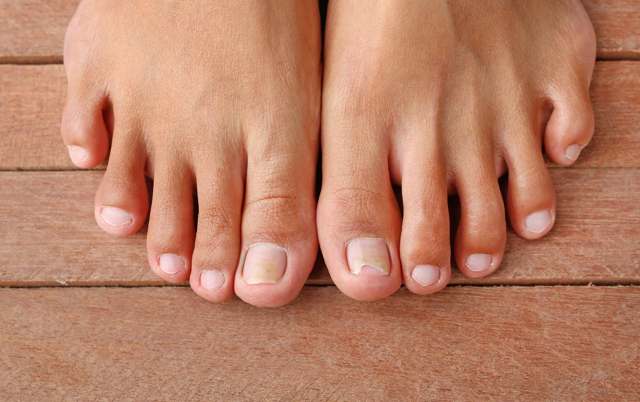 Stubbed Toe Treatment When Do You Need To Seek Help?
