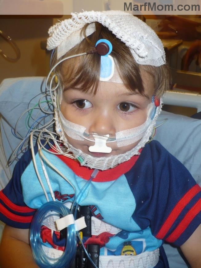 Sleep Study Pictures