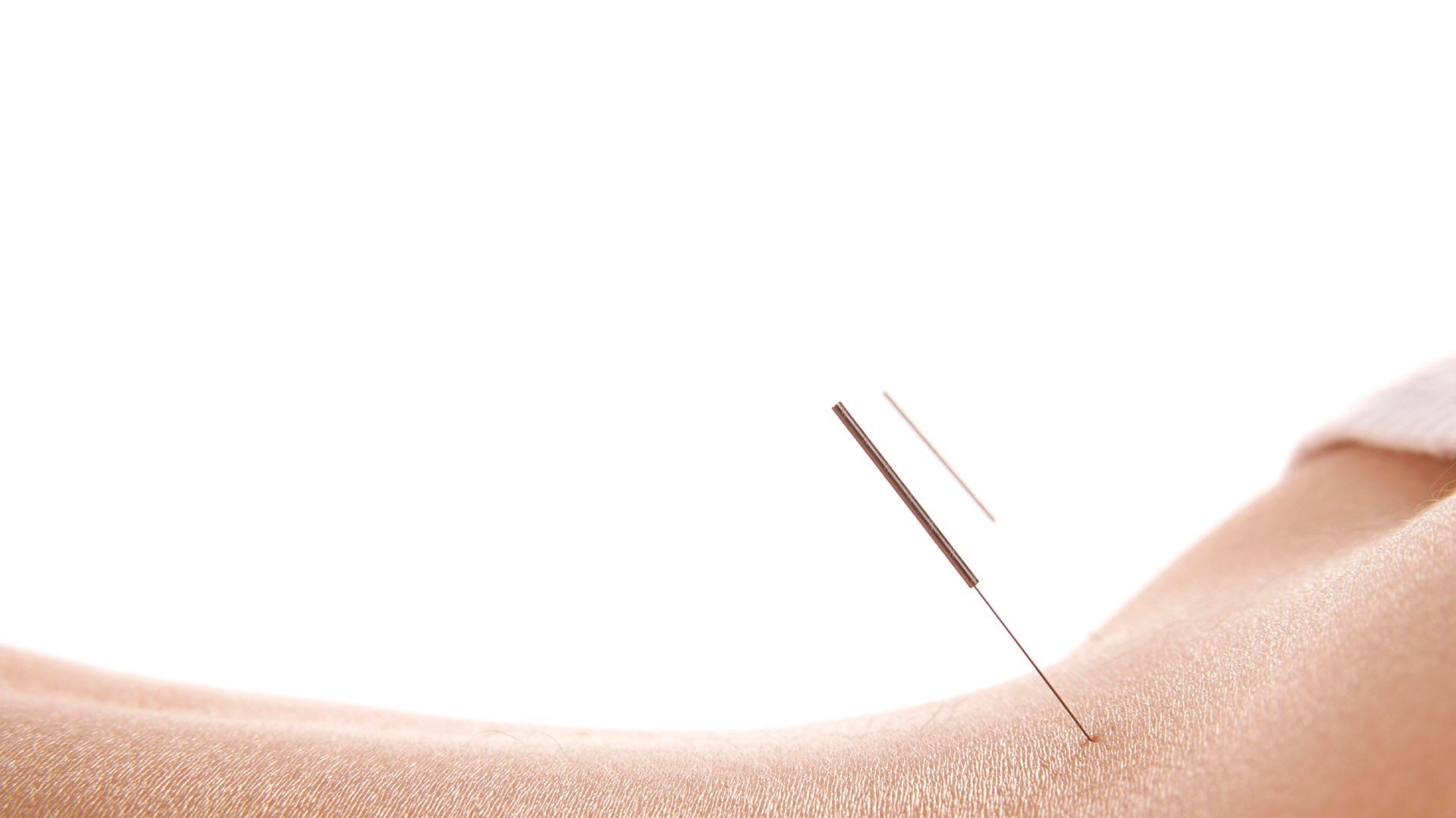 Akupunktur Ulm PRAXIS FÜR TCM KRÄUTERTHERAPIE AKUPUNKTUR Dr