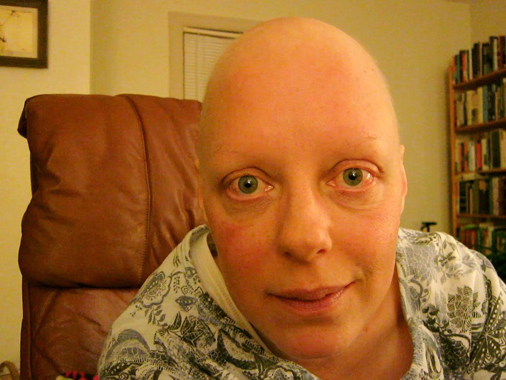 Breast cancer Amy's blog & video journey — chemo, surgery, radiation