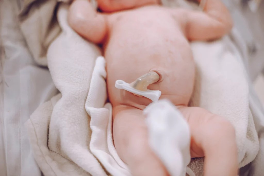 Umbilical Cord Care at Home basics for the best start Marta Almansa