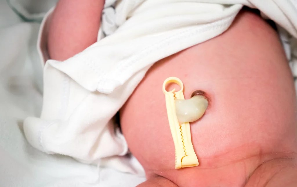 Umbilical Cord Care at Home basics for the best start