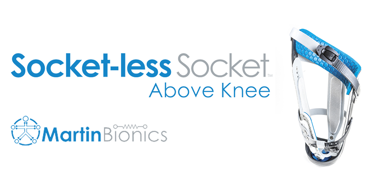 Above Knee Socketless Socket™ — Martin Bionics