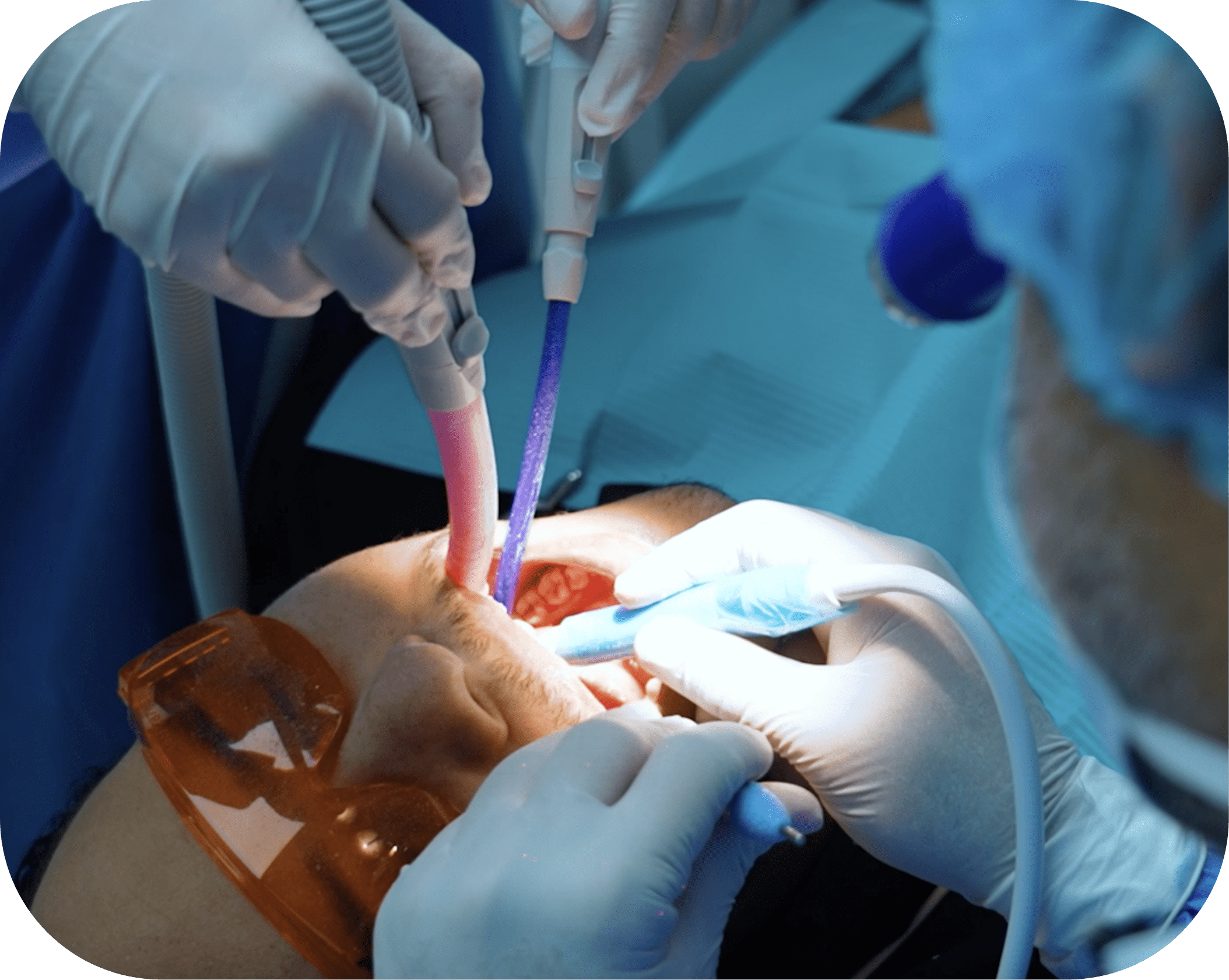 Dental Care Clinic Dental Health Care Services in Fujairah