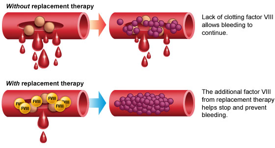 Masterman 7th Grade Science / 735 GDR Treatments and Therapies