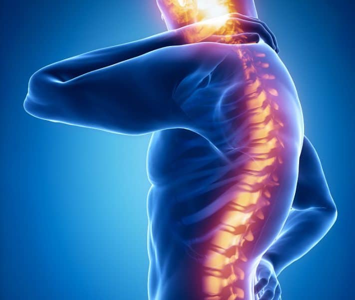 The Importance of Posture Kyphosis Mat Boulé, Osteopath