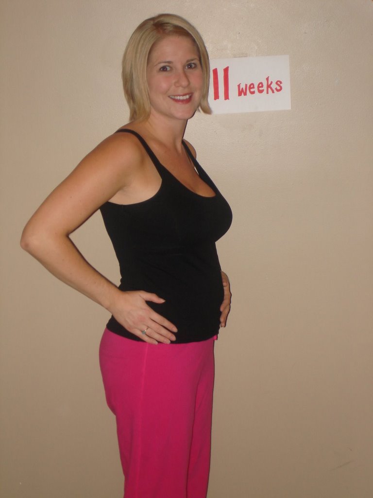 11weeks704982 The Maternity Gallery