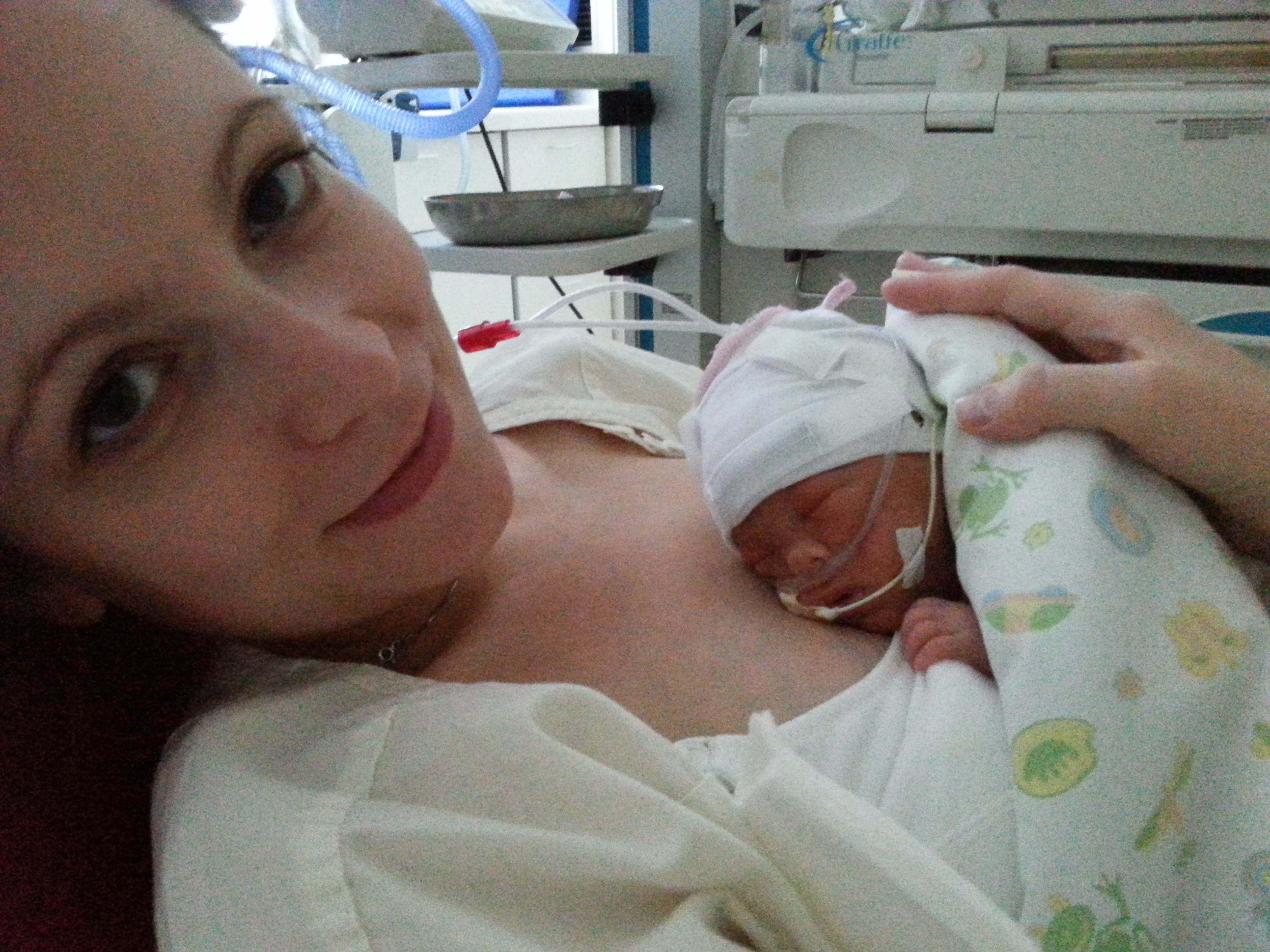 Premature Baby Born At 28 Weeks Newborn baby