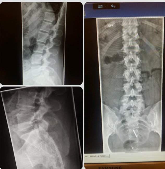 Problem med ländryggen? Matkärlek