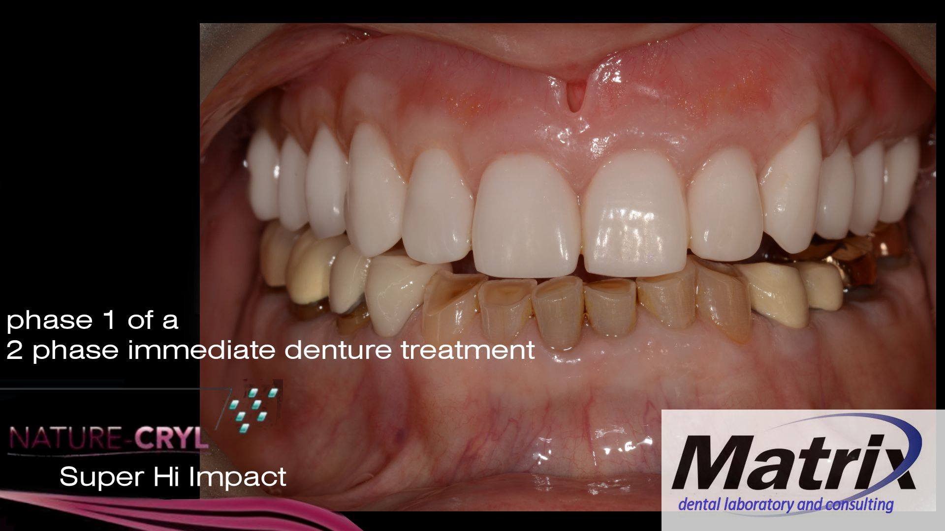 Photographic Portfolio matrix dental Laboratory and consulting