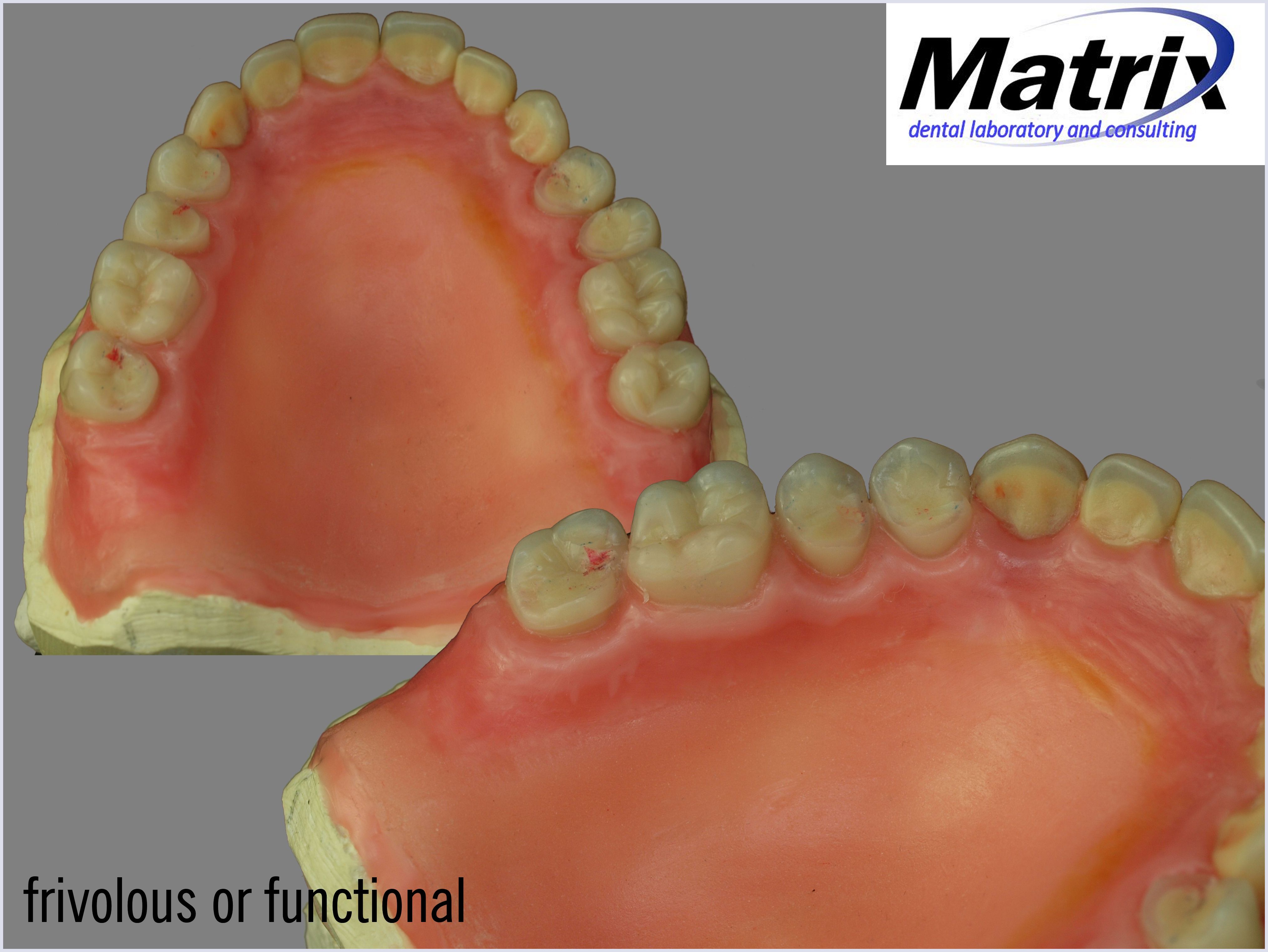 Photographic Portfolio matrix dental Laboratory and consulting
