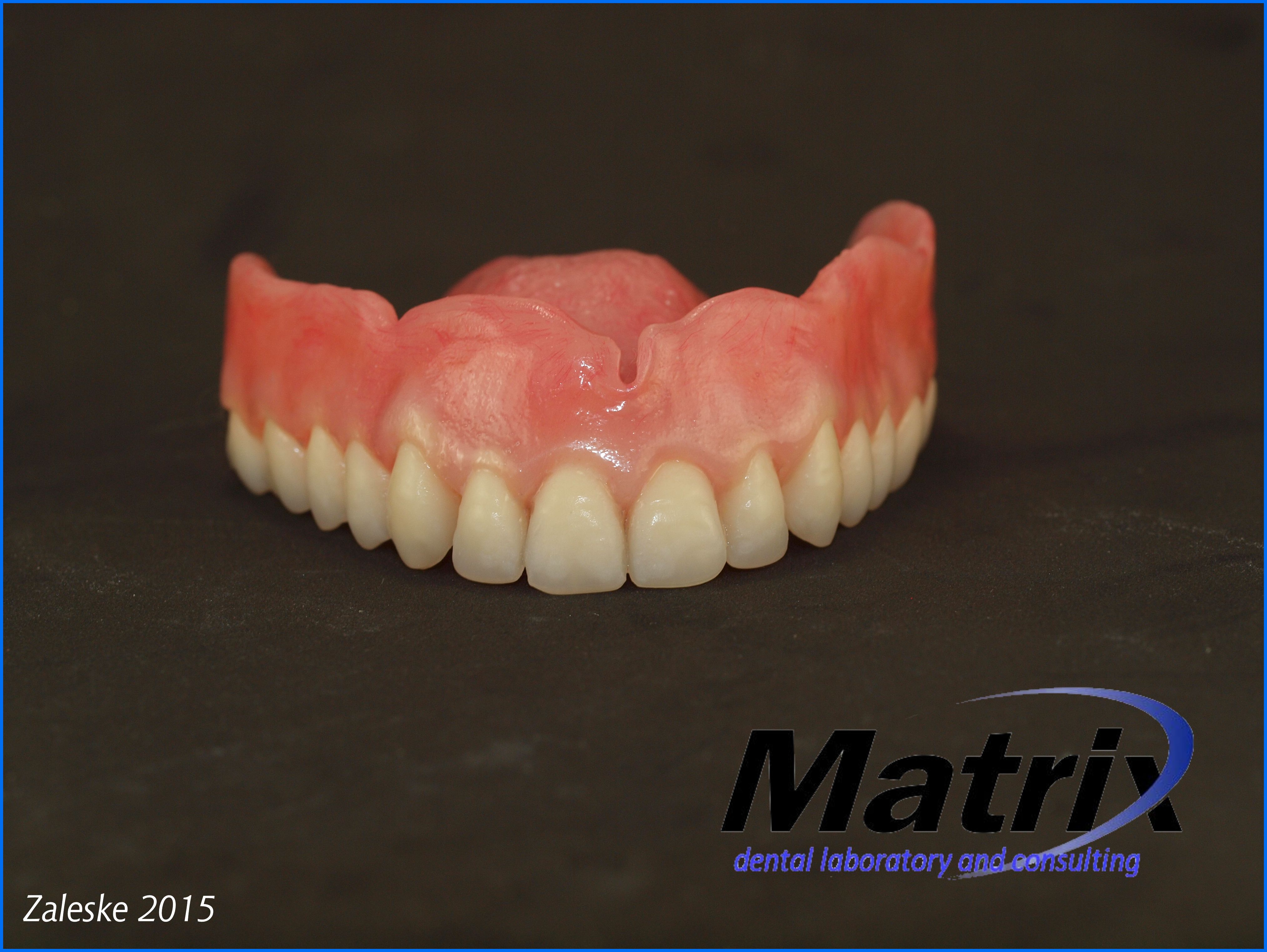 Photographic Portfolio matrix dental Laboratory and consulting