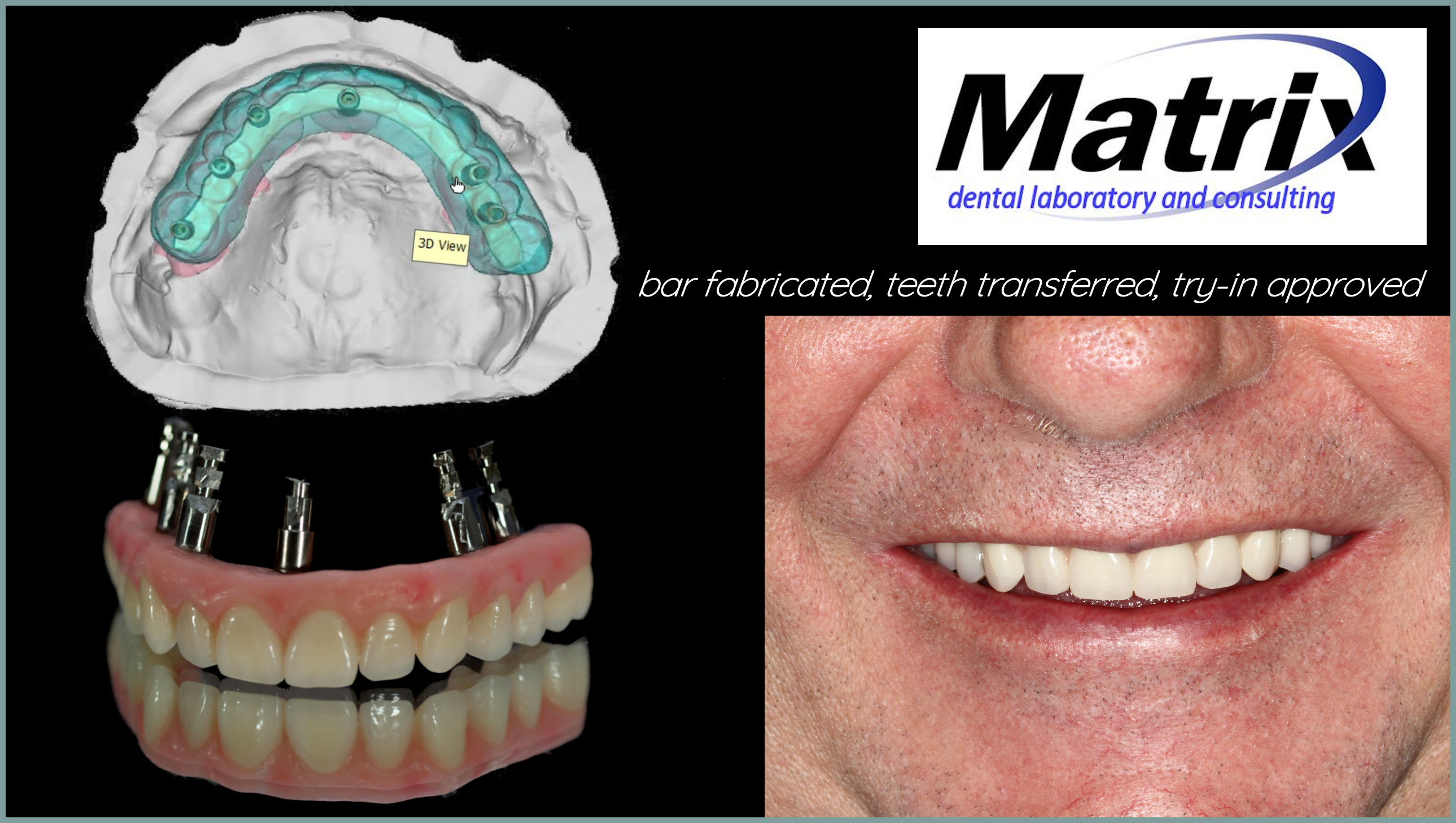 Photographic Portfolio matrix dental Laboratory and consulting