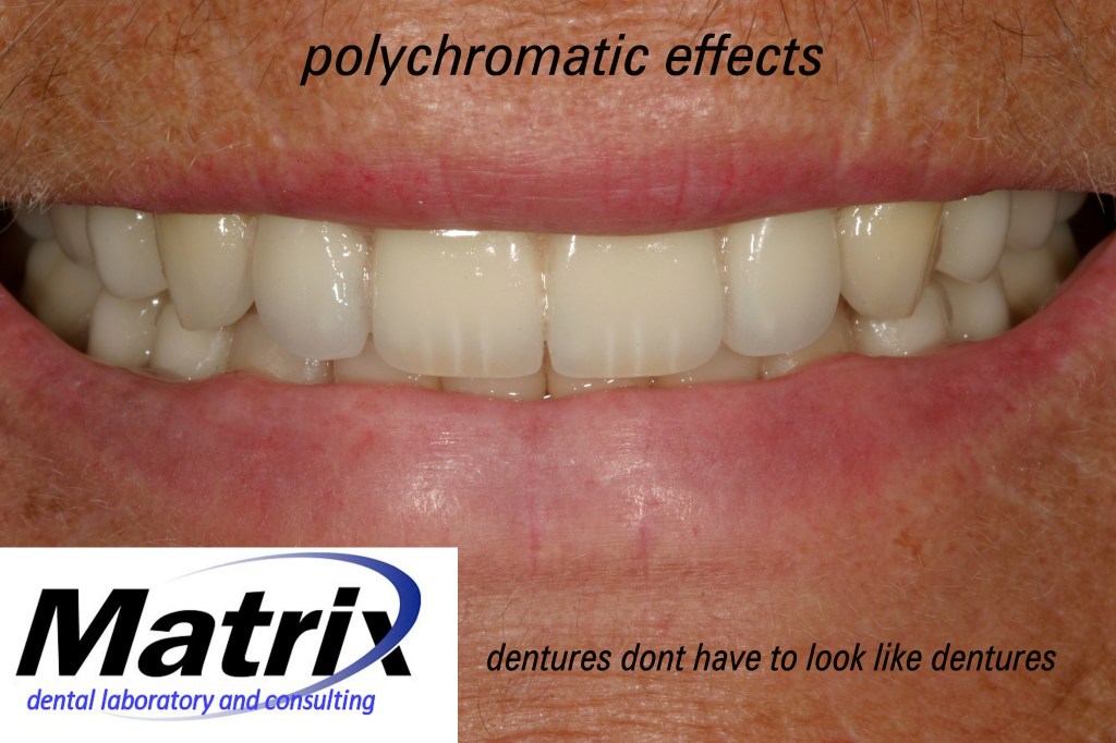 Naturally Appropriate Esthetics Matrix Dental Laboratory and Consulting