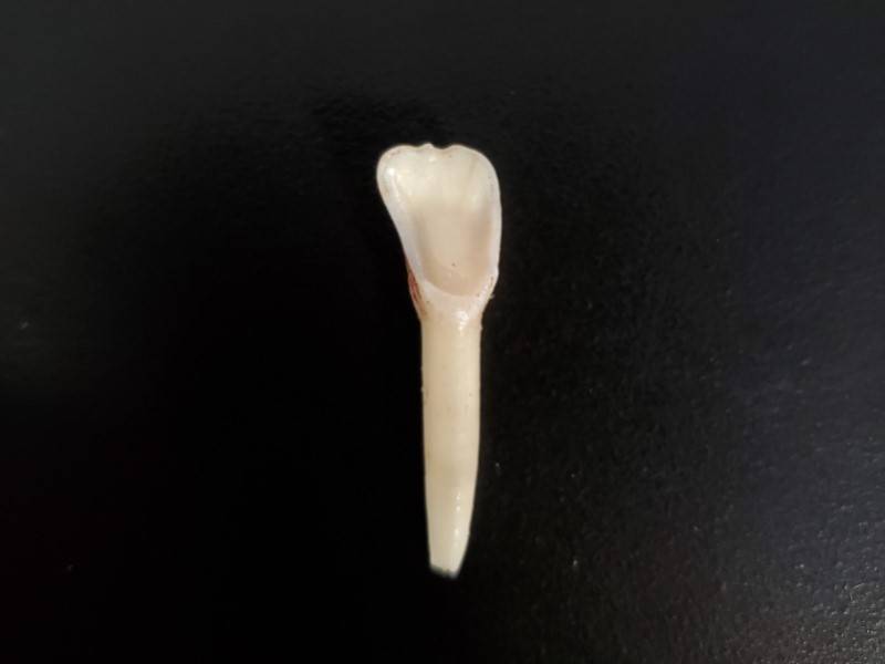 Cementum Annuli Deer Aging Matson's Laboratory