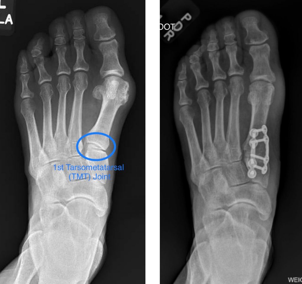 Jessica Kohring, MD. Spokane Orthopaedic Foot & Ankle Specialist